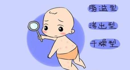 婴儿湿疹怎么护理不复发杏璞霜应对湿疹有妙招